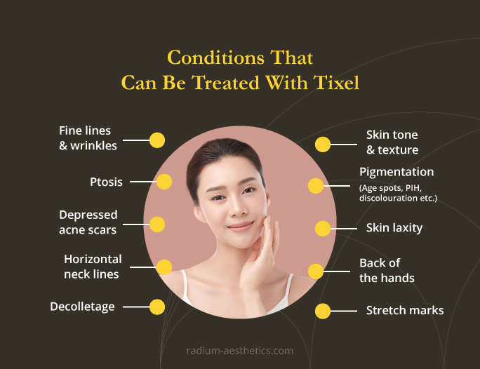 Tixel Treatment Radium Medical Aesthetics Singapore