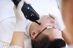 acne scar treatment singapore