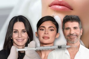 More and more celebrities are dissolving their facial fillers