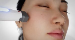 Skin Tightening Treatment
